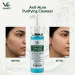 ANTI-ACNE Purifying Cleanser