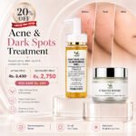 Acne & Dark Spots Treatment