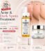 Acne & Dark Spots Treatment