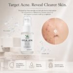 Clear Acne Dual Serum - Image 2