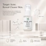 Clear Acne Dual Serum - Image 4