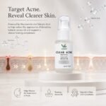Anti Acne Spot Clearing Kit - Image 3