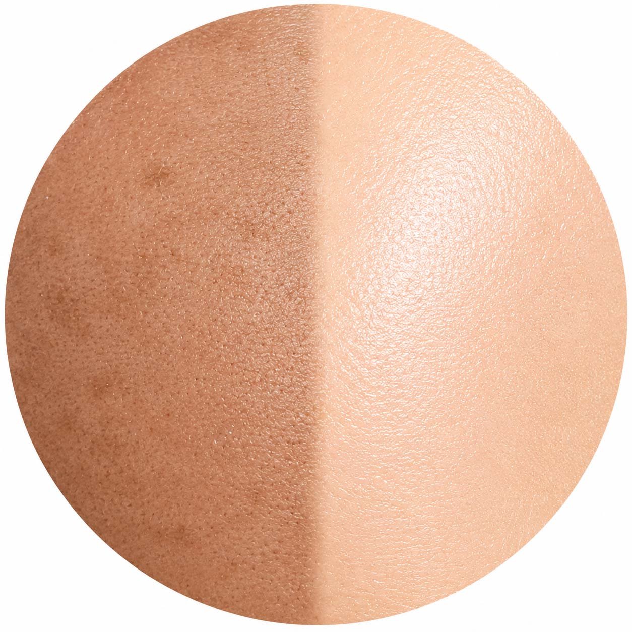 Dullness & Skin Brightening