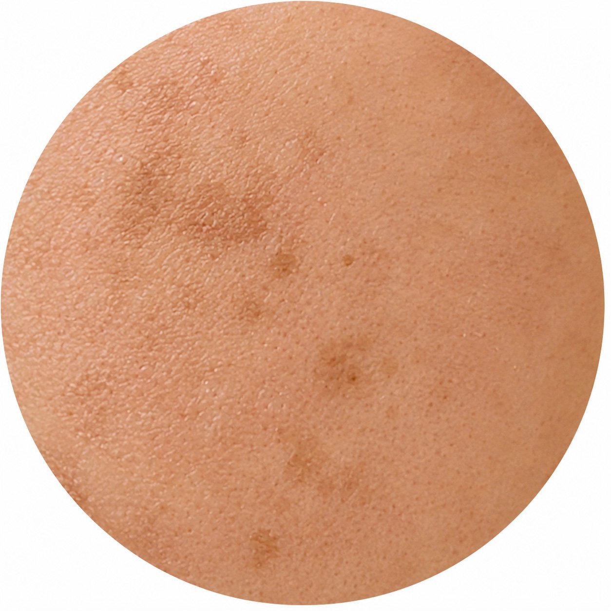 Pigmentation & Dark Spots